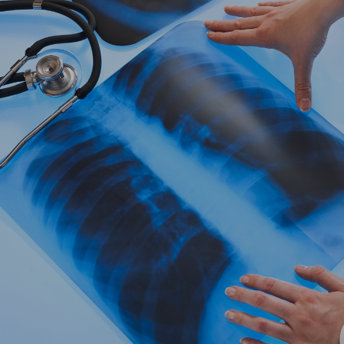pulmonology overlay